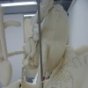 The Intestine Woman1***