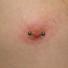 Nipple