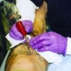 CRAIG WORKING ANDREWS LEG