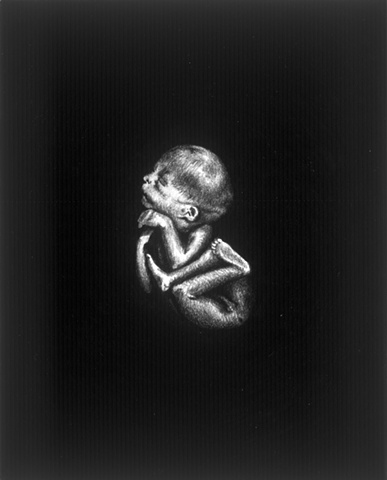 Fetus