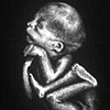 Fetus