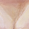 Bruise IV