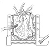 Cardiac Schematic & Bypass Architecture