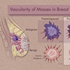 Breast Cancer Architecture