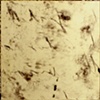 Love & Squalor Series