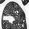 Accumulations, cacoon