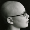 Alopecia