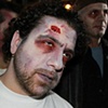 Gonz Zombie