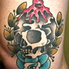 Craiggy's knee healed