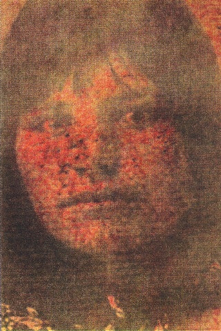 Scar 