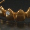 Add Some Sparkle to that Smile (3rd view)