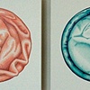 Assorted Condoms