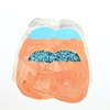 Chin Scape