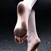 Dirty Feet