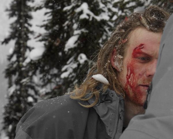Ski in the head...
