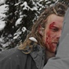 Ski in the head...