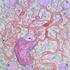 Intestinal Neuronic