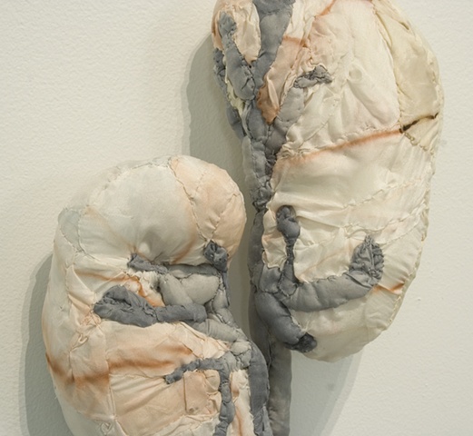 Detail (kidneys)