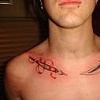 cuts