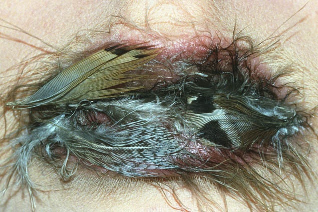 anika Smulovitz Lips Untitled feathers