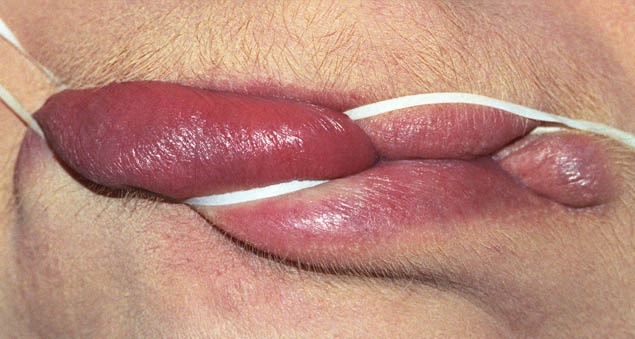 Smulovitz Lips Untitled (manipulate 1)