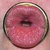 Untitled (ring)
