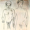 Conjointtwin Before And After