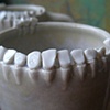 Teeth cups (detail)