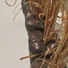 Wisdom teeth detail 2