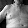 My Father at 79 yrs.