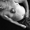Open Heart