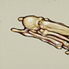 Mummified Remains