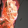 Fissure