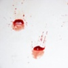 Drops