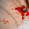 Nosebleed