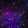 Effluget Particulates