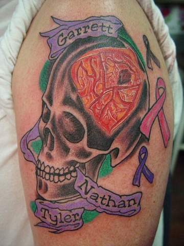 Ralph, his brain after tumor removal.