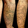 Forearm