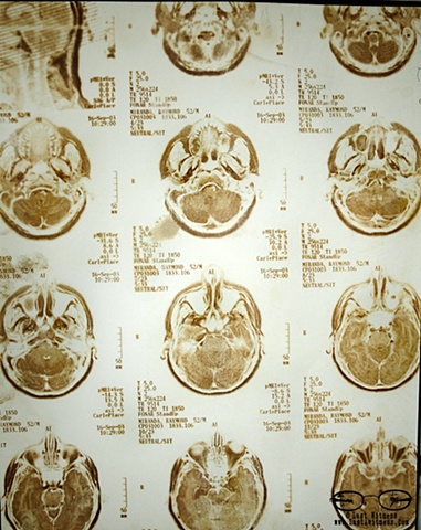 Van Dyke Brown created from my fathers  MRI xrays