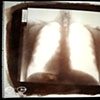 Van Dyke Brown created from my fathers  chest xray