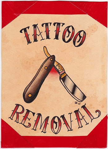 Tattoo Removal