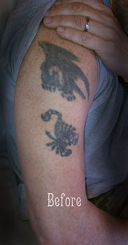 Biomech sleeve coverup Before
