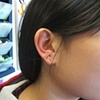 anti tragus