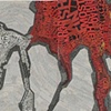 Internal Bleeding 
