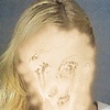 Hilton Facial" 