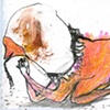 113