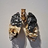 Lead Lungs