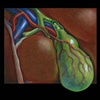 Odd View of Liver and Gallbladder