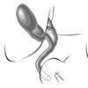 Bile Duct Variations