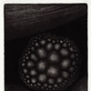 Nodule 3